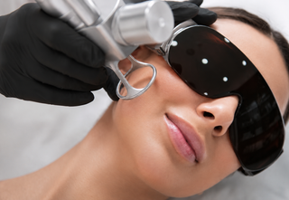 FreshPeel CO₂ Laser Treatment: Gentle Skin Resurfacing with Minimal Downtime