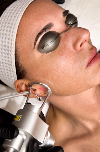 IPL vs. CO2 Laser: Which Skin Treatment Is Right For You?