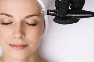 Customized Skin Renewal: From Microdermabrasion to Advanced Microneedling
