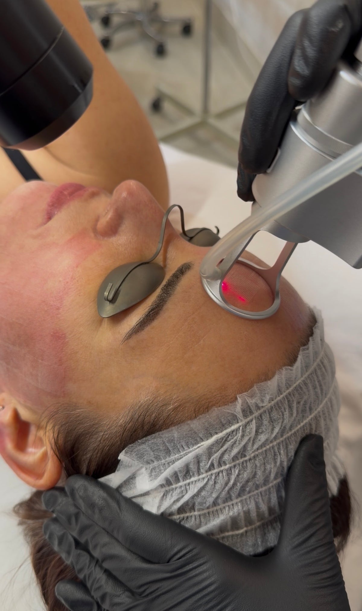 Full Skin Rejuvenation